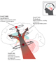 The three phases of Parkinson's disease